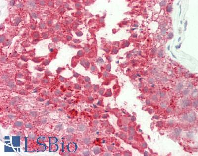 Human Testis: Formalin-Fixed, Paraffin-Embedded (FFPE)