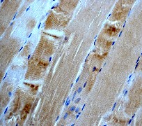 IHC of paraffin-embedded human muscle using anti-Glycogen Synthase antibody.