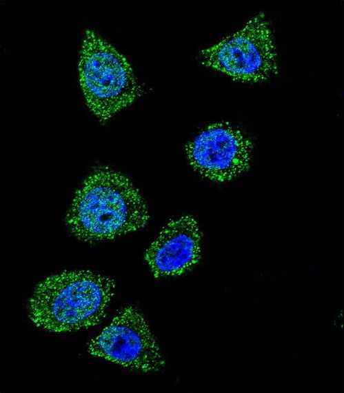 Confocal immunofluorescent of TOP1 Antibody with HeLa cell followed by Alexa Fluor 488-conjugated goat anti-rabbit lgG (green). DAPI was used to stain the cell nuclear (blue).