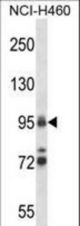 TOP1 Antibody western blot of NCI-H460 cell line lysates (35 ug/lane). The TOP1 antibody detected the TOP1 protein (arrow).