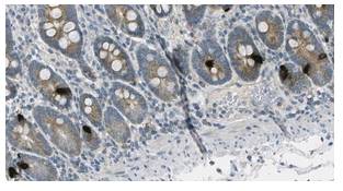 IHC of paraffin-embedded human duodenum tissue.