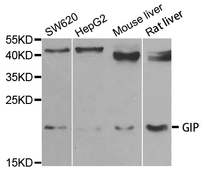 Western blot analysis of extracts of various cell lines, using GIP antibody.