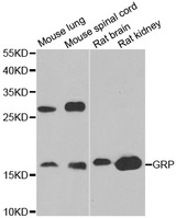 Western blot analysis of extracts of various tissues, using GRP antibody.