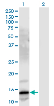 Western Blot analysis of GRP expression in transfected 293T cell line by GRP monoclonal antibody (M03), clone 3A11.Lane 1: GRP transfected lysate(16.39 KDa).Lane 2: Non-transfected lysate.