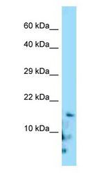 GRP/Gastrin Releasing Peptide antibody Western Blot of HepG2.