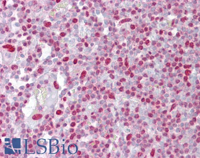 Anti-H2AX antibody IHC of human tonsil. Immunohistochemistry of formalin-fixed, paraffin-embedded tissue after heat-induced antigen retrieval. Antibody LS-B6918 concentration 5 ug/ml.