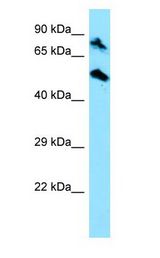 TOP1MT antibody Western Blot of HepG2.
