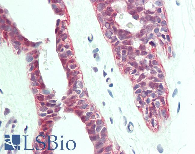 Anti-PTPLA antibody IHC staining of human breast. Immunohistochemistry of formalin-fixed, paraffin-embedded tissue after heat-induced antigen retrieval. Antibody LS-B10947 dilution 1:100.