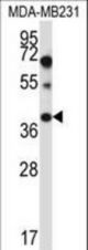 PTPLA Antibody western blot of MDA-MB231 cell line lysates (35 ug/lane). The PTPLA antibody detected the PTPLA protein (arrow).