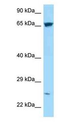 C17orf66 antibody Western Blot of 293T.