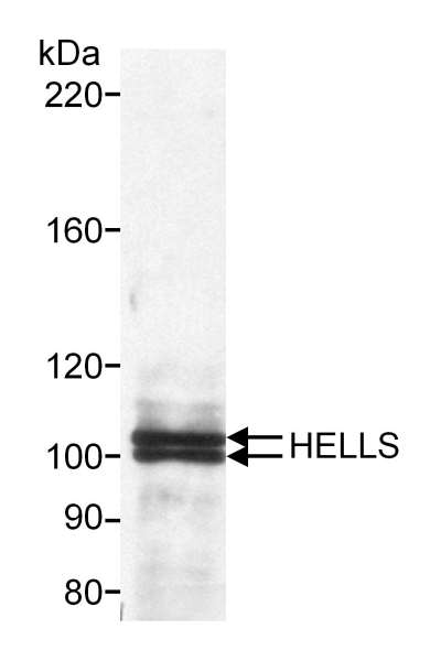 Detection of Human HELLS by Western Blot of Immunoprecipitate. Sample: Nuclear extract (1 mg) from HeLa cells. Antibody: Affinity purified rabbit anti-HELLS used at 2 ug/mg lysate for IP and 0.5 ug/ml for Western Blot. Detection: Chemiluminescence with 30 second exposure.