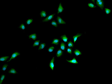 Immunofluorescence analysis of A549 cell using KDM3A antibody. Blue: DAPI for nuclear staining.