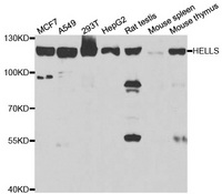 Western blot analysis of extracts of various cell lines, using HELLS antibody.