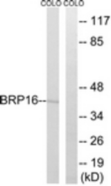Western blot of extracts from COLO cells, using BRP16 Antibody. The lane on the right is treated with the synthesized peptide.