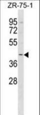 BRP16 Antibody western blot of ZR-75-1 cell line lysates (35 ug/lane). The BRP16 antibody detected the BRP16 protein (arrow).