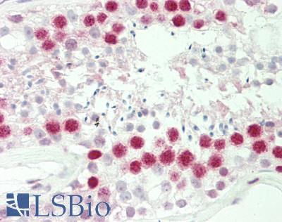 Human Testis: Formalin-Fixed, Paraffin-Embedded (FFPE)