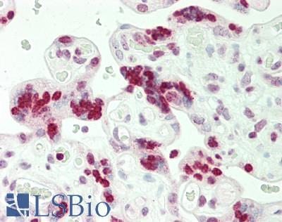 Human Placenta: Formalin-Fixed, Paraffin-Embedded (FFPE)