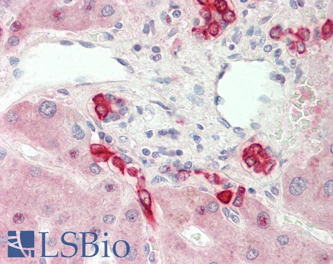 Human Liver: Formalin-Fixed, Paraffin-Embedded (FFPE)