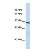 Western blot of Human Fetal Lung. HMHA1 antibody dilution 1.0 ug/ml.