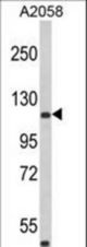 Western blot of HMHA1 Antibody in A2058 cell line lysates (35 ug/lane). HMHA1 (arrow) was detected using the purified antibody.