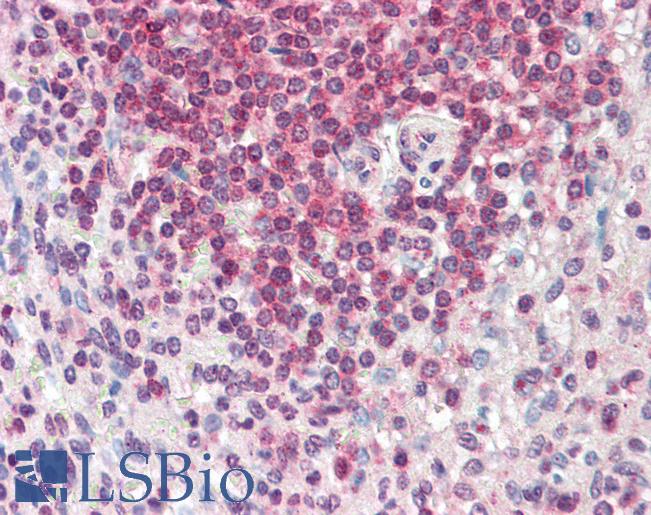 Anti-HMHA1 / HA1 antibody IHC staining of human spleen. Immunohistochemistry of formalin-fixed, paraffin-embedded tissue after heat-induced antigen retrieval. Antibody LS-B10342 concentration 5 ug/ml.
