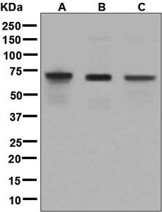 Western blot analysis on (A) Caco-2, (B) fetal kidney, and (C) SK-OV-3 lysates using anti-HNF1B / TCF2 antibody.