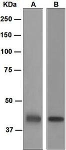 Western blot analysis on (A) HepG2 and (B) fetal liver lysates using anti-HPD antibody.