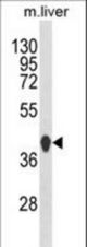 Western blot of HPD Antibody in mouse liver tissue lysates (35 ug/lane). HPD (arrow) was detected using the purified antibody.