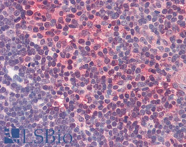 Anti-HPGDS / PGDS antibody IHC of human thymus. Immunohistochemistry of formalin-fixed, paraffin-embedded tissue after heat-induced antigen retrieval. Antibody LS-B2422 concentration 10 ug/ml.