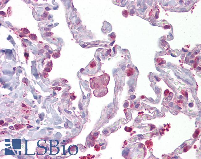 Anti-HPGDS / PGDS antibody IHC of human lung. Immunohistochemistry of formalin-fixed, paraffin-embedded tissue after heat-induced antigen retrieval. Antibody LS-B6886 concentration 5 ug/ml.