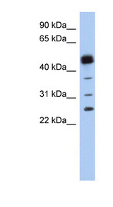HPGDS / PGDS antibody LS-B6886 Western blot of Fetal Spleen lysate.