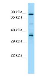 HSP90AA1 / Hsp90 antibody Western Blot of Mouse Thymus.