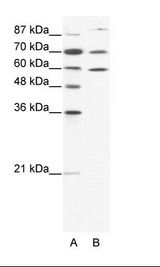A: Marker, B: HepG2 Cell Lysate