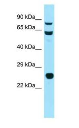 HSP90AB1 / HSP90 antibody Western Blot of Mouse Thymus.