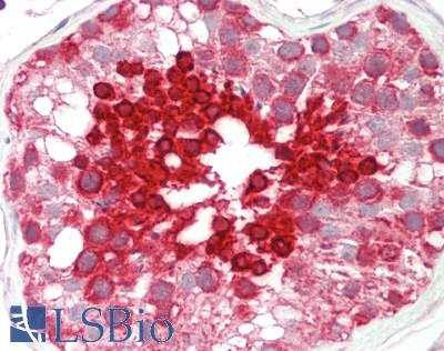 Human Testis: Formalin-Fixed, Paraffin-Embedded (FFPE)