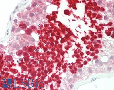 Human Testis: Formalin-Fixed, Paraffin-Embedded (FFPE)