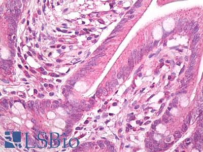 Anti-HSP27 / Heat Shock Protein 27 antibody IHC of human small intestine. Immunohistochemistry of formalin-fixed, paraffin-embedded tissue after heat-induced antigen retrieval. Antibody LS-B7979 dilution 10 ug/ml.
