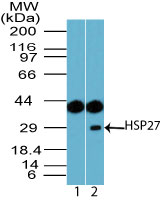 Western blot of HSP27 in human skeletal muscle lysate using 1) preimmune sera at 1:5000 and 2) peptide affinity purified LS-B7979 at 2.0 ug/ml. Goat anti-rabbit Ig HRP secondary antibody, and PicoTect ECL substrate solution, were used for this test.