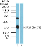 Western blot of HSP27 (Ser78) in recombinant fusion protein containing 1) a phosphorylated serine at position 78 and 2) an unphosphorylated serine at position 78, using HSP27 phospho antibody at 0.01 ug/ml. Goat anti-rabbit Ig HRP secondary antibody, and PicoTect ECL substrate solution, were used for this test.