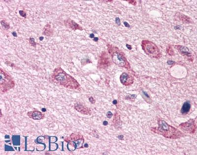 Anti-5HT7 Receptor antibody LS-A6675 IHC of human brain, neurons and glia. Immunohistochemistry of formalin-fixed, paraffin-embedded tissue after heat-induced antigen retrieval.