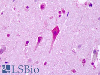 Anti-HT7 / 5-HT7 antibody IHC of human brain, cortex, neurons. Immunohistochemistry of formalin-fixed, paraffin-embedded tissue after heat-induced antigen retrieval. Antibody LS-A6674 concentration 19 ug/ml.