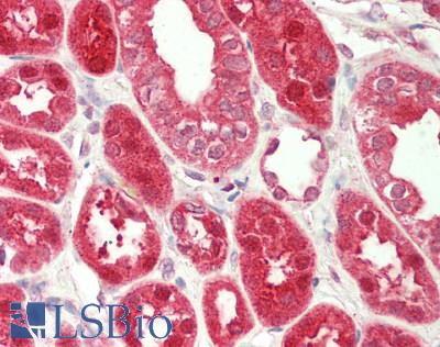 Human Kidney: Formalin-Fixed, Paraffin-Embedded (FFPE)