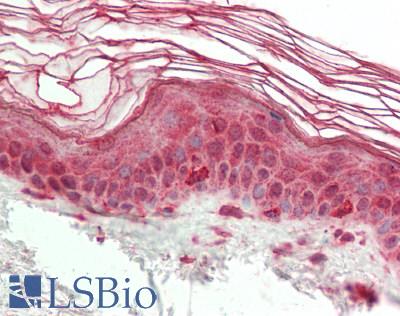 Human Skin: Formalin-Fixed, Paraffin-Embedded (FFPE)