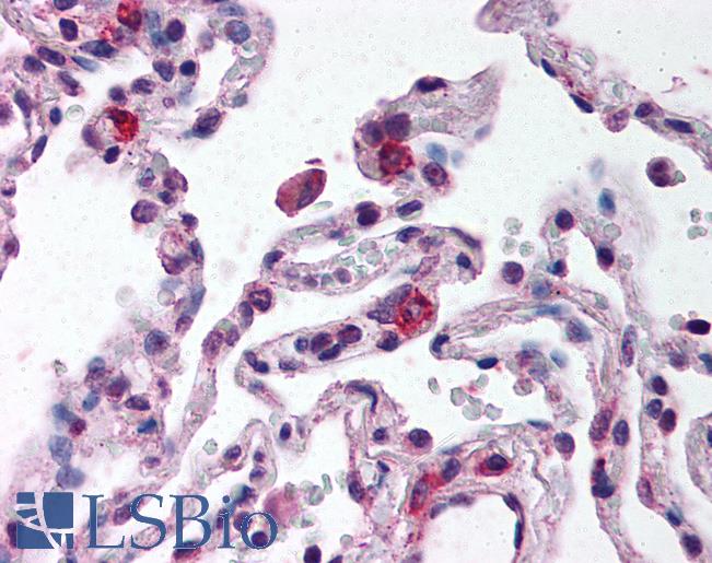 Anti-TLR9 antibody IHC of human lung. Immunohistochemistry of formalin-fixed, paraffin-embedded tissue after heat-induced antigen retrieval. Antibody LS-B688 concentration 10 ug/ml.