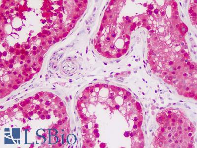 Human Testis: Formalin-Fixed, Paraffin-Embedded (FFPE)