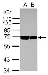 Sample (30 ug of whole cell lysate) A: A431 B: HeLa 7.5% SDS PAGE HSPA1B antibody diluted at 1:1000