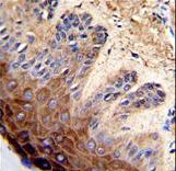 Formalin-fixed and paraffin-embedded human skin with TOP2A Antibody , which was peroxidase-conjugated to the secondary antibody, followed by DAB staining. This data demonstrates the use of this antibody for immunohistochemistry; clinical relevance has not been evaluated.