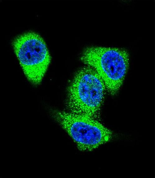 Confocal immunofluorescent of TOP2A Antibody with HeLa cell followed by Alexa Fluor 488-conjugated goat anti-rabbit lgG (green). DAPI was used to stain the cell nuclear (blue).