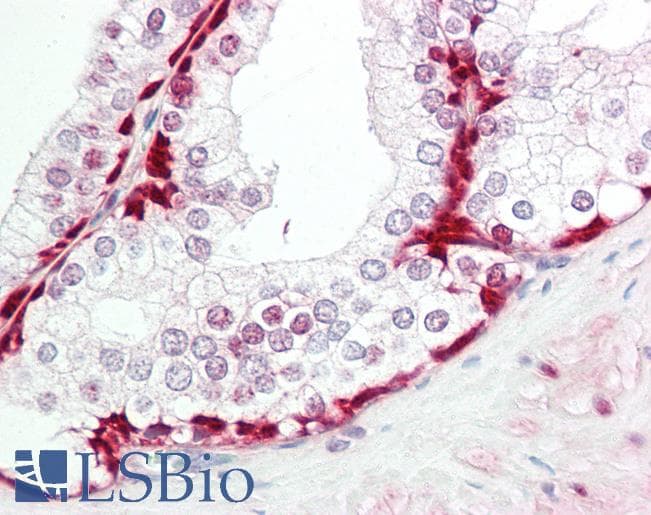 Human Prostate: Formalin-Fixed, Paraffin-Embedded (FFPE)