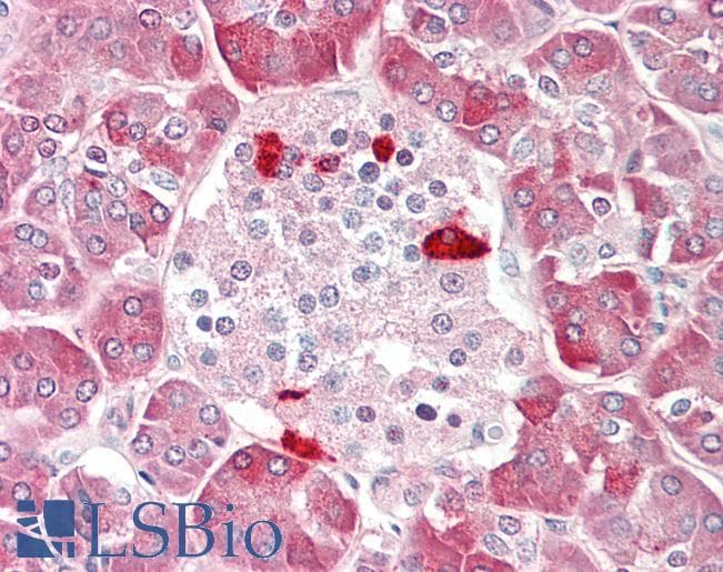 Human Pancreas: Formalin-Fixed, Paraffin-Embedded (FFPE)